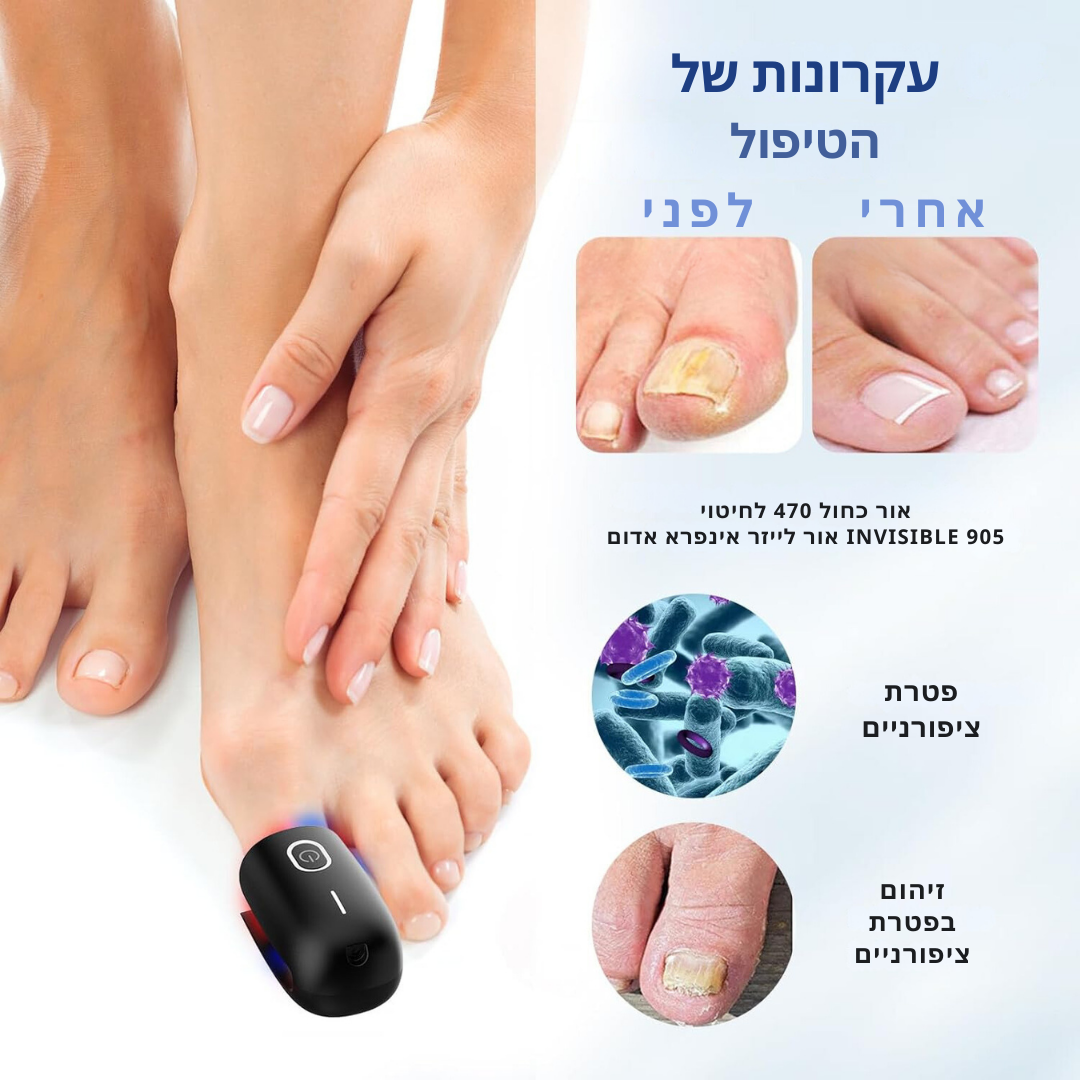 ClearNailPro™ – מכשיר לייזר מתקדם לטיפול מהיר בפטרת ציפורניים